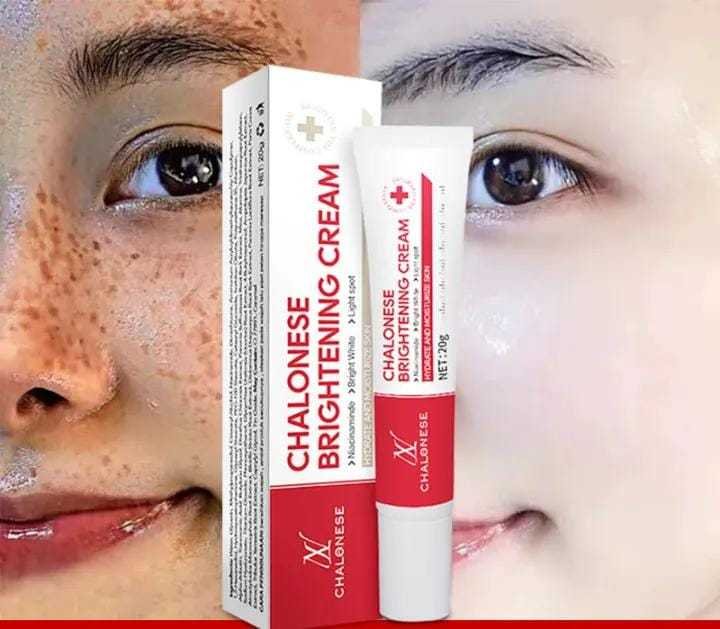 Chalonese Brightening Cream in Pakistan