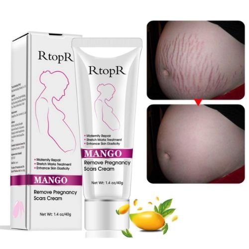 Mango Stretch Mark Cream In Pakistan