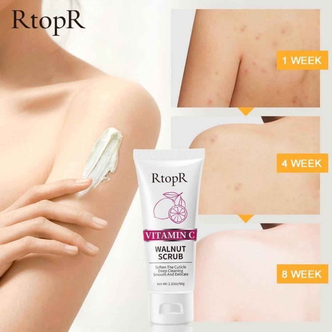 RtopR Vitamin C Walnut Scrub In Pakistan