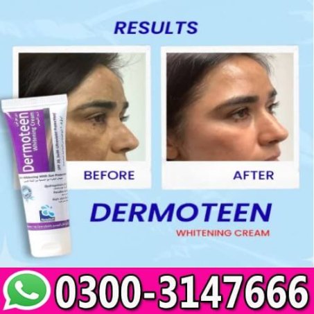 Dermoteen Whitening Cream In Pakistan