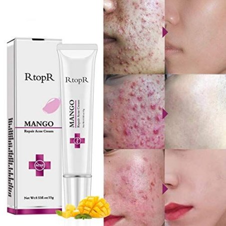 Mango Acne Cream In Pakistan