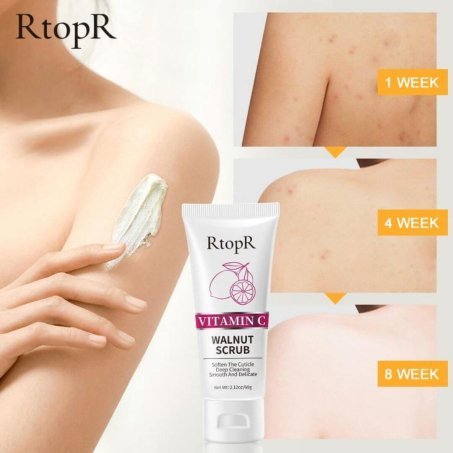 RtopR Vitamin C Walnut Scrub In Pakistan