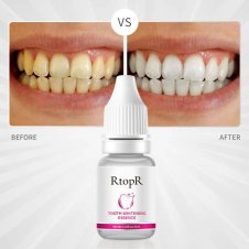  Tooth Whitening Essence Whitening Teeth In Pakistan